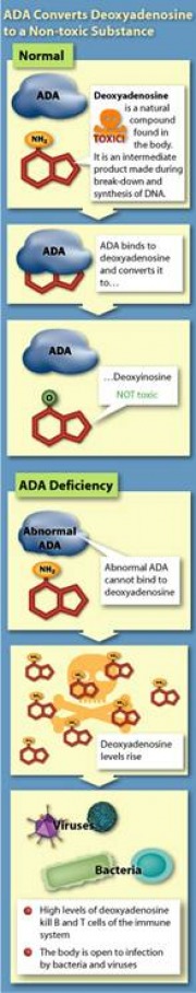 scid adenosine deaminase